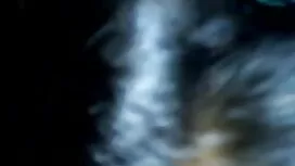 সিলভিয়া Dellai এবং  ...